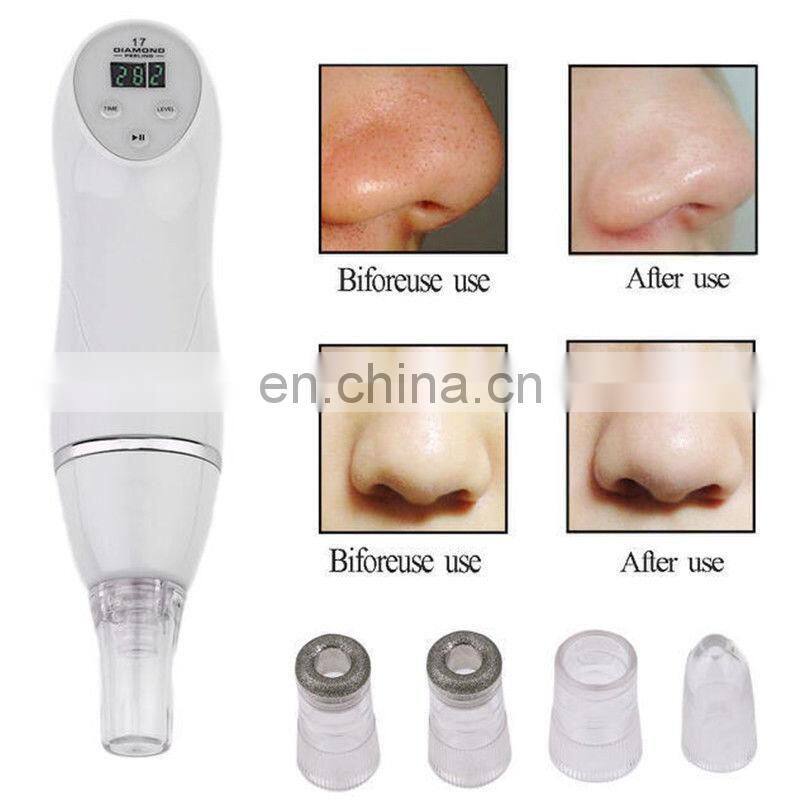 Hot Selling Portable Multi-Functional Blackhead Removal Machine /Eye Wrinkle Remover /Diamond Dermabrasion Machine