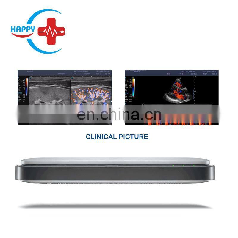 Great performance Sonoscape x5 portable ultrasound probe/Ultrasound diagnostic/Sonoscape
