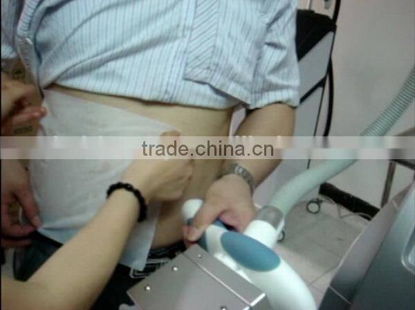 hotsale fat freeze lose weight Cryo pad antifreeze membrane / anti freeze membrane for sale