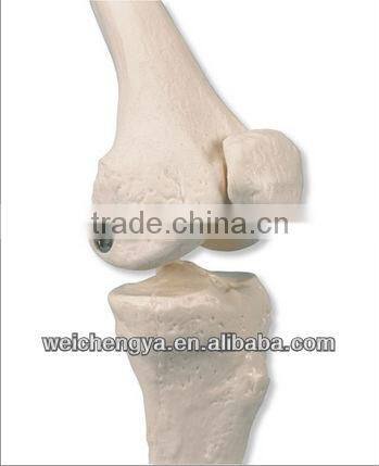 85cm Skeleton with Painted Muscles on Pelvic Mounted Base