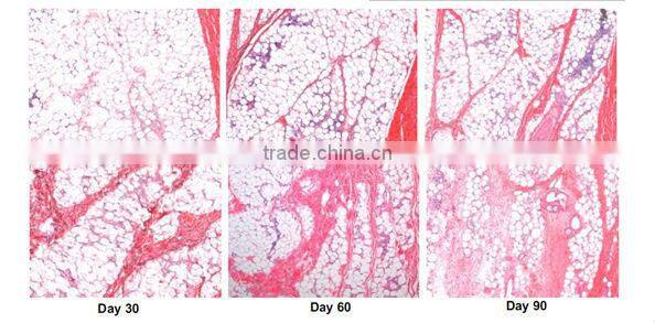 BD09B Lipo laser/vacuum roller/cavitation slimming machine