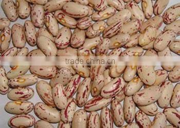all sizes round Light Speckled Kidney Beans