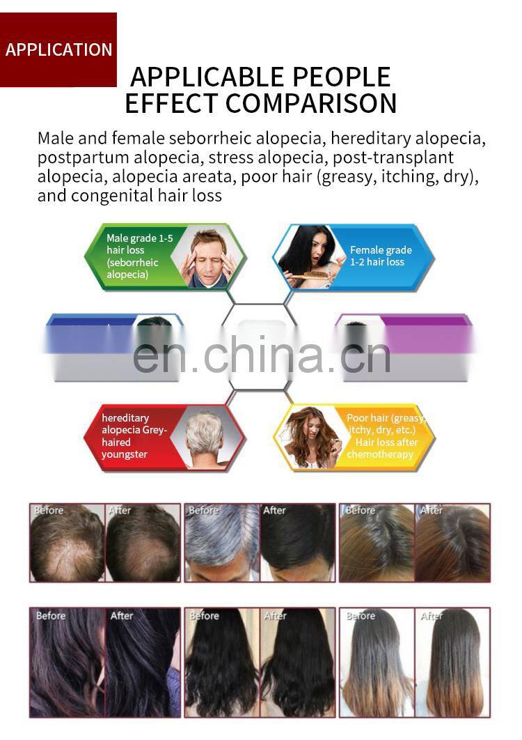 Salon Professional Anti Hair Loss Laser Diodes Machine Hair Follicle Detection Analysis Scalp Massager Hair Growth Machine