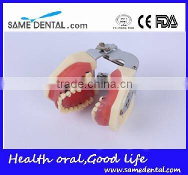 Dental Severe Periodontal Disease Model School Teaching