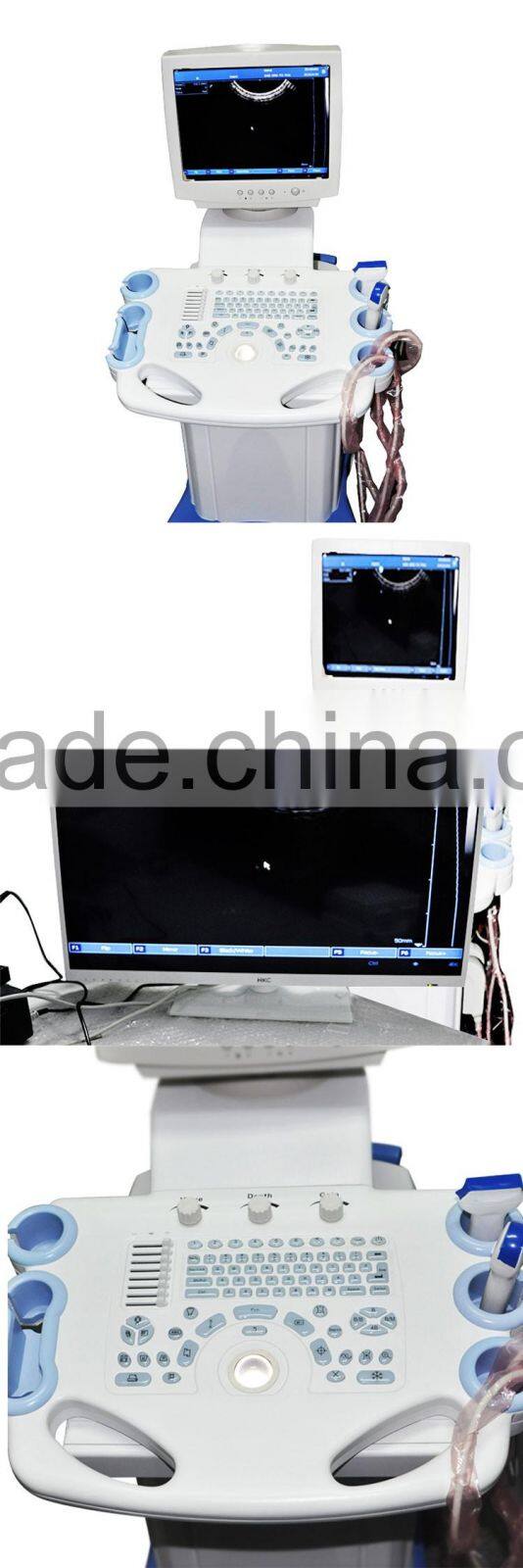 White+Bule wholesale Medical Supplier digital Ultrasound Machine for Pregnancy