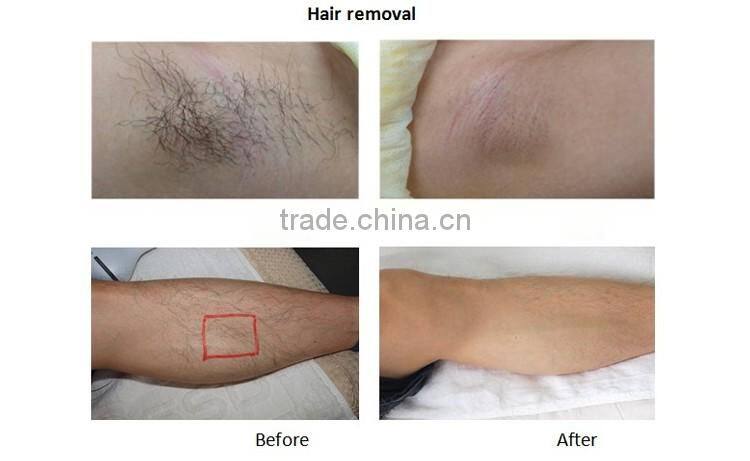 IPL personal skin care home use beauty device/best sale 2019