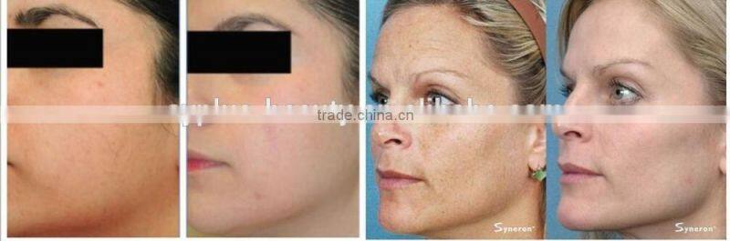 AYJ-TG06 ayplus vibrating massage heat pad