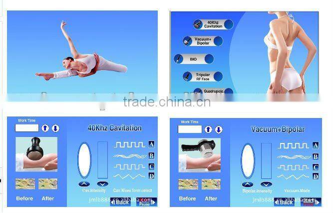 Hot Sale massager lymphatic drainage,lymphatic drainage device,rf vacuum lymphatic drainage