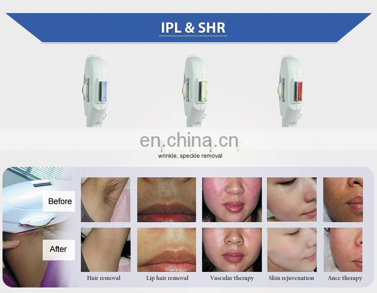 Multifunction IPL SHR Hair removal & RF Beauty Machine