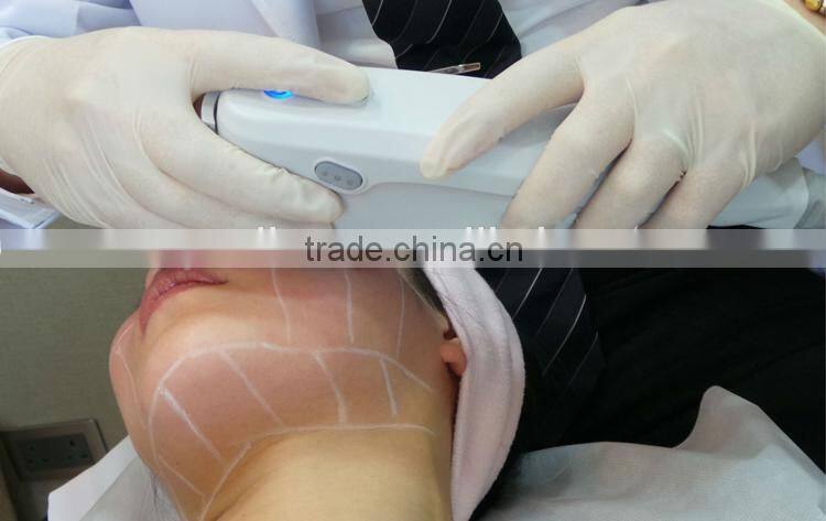 HIFU Facial Beauty Machine for Face lift Brow Lift