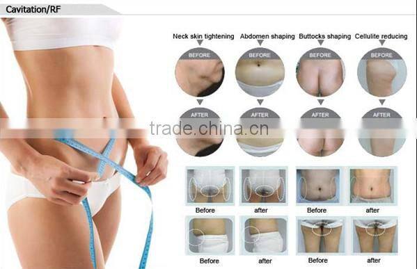 fat cavitation slimming equipment/fast cavitation slimming system/cavitation slimming machine