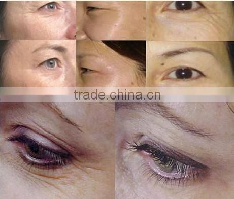 Hot sale!! LED galvanic Derma roller/skin roller on best price--CTS-540