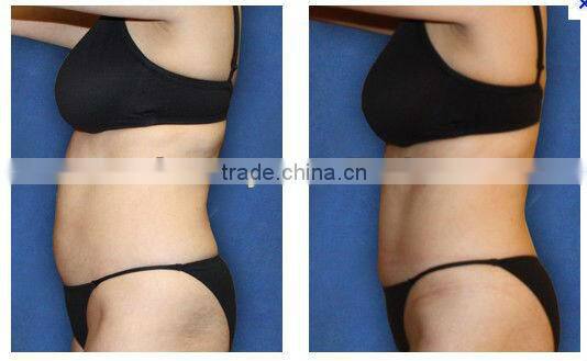 Jimpness Beauty Fat Loss Infrared Fat Burning Massager F019