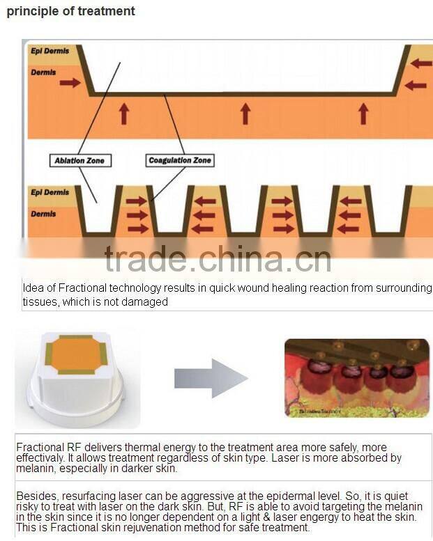 Very excellent portable wrinkle removal radio frequency rf machine for clinic beauty spa and so on