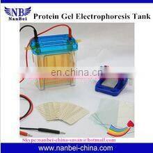 Assessment serum protein electrophoresis in clinical diagnosis