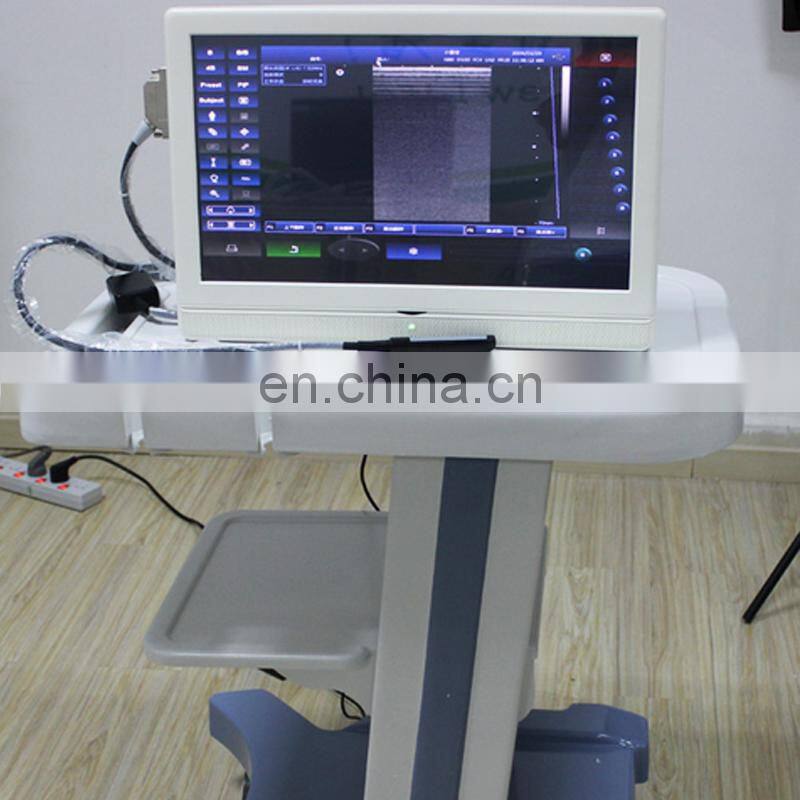 HC-A005 Pregnancy Ultrasound Scan/Medical Diagnostic Equipment/18 inch large LCD