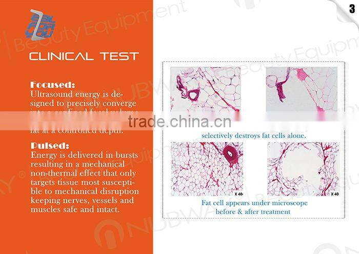 2014 newest high intensity focused ultrasound hifu