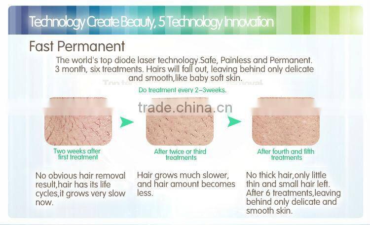 Best Selling Products 808 Diode Laser Machine For Home Use Hair Removal