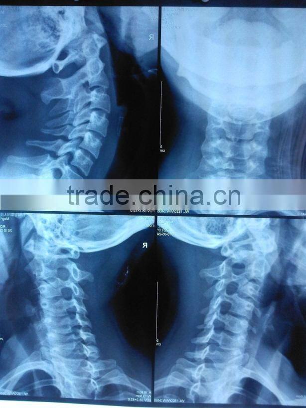 China fuji medical x-ray film KND film with CE