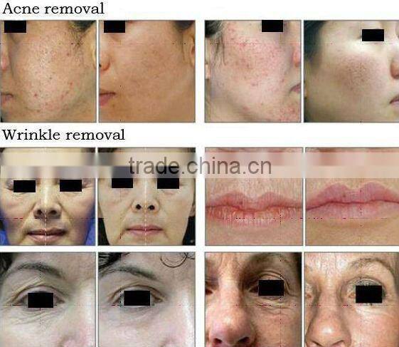 S0-07 Almighty Skin Oxyen Spray Beauty Instrument