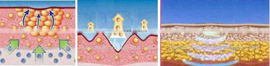 AYJ-T28 low price portable rf fractional thermagic/CPT thermagic face lifting wrinkle removal/thermagic machine for home use