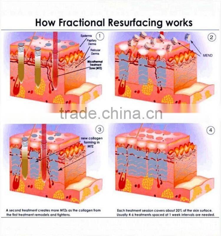 long warranty co2 fractional laser therapy with good quality and cheap price