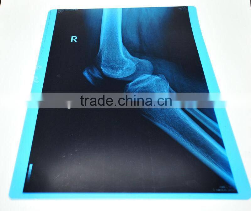 For Epson Waterbased Pigment Ink for Uncoated Film Plate Making