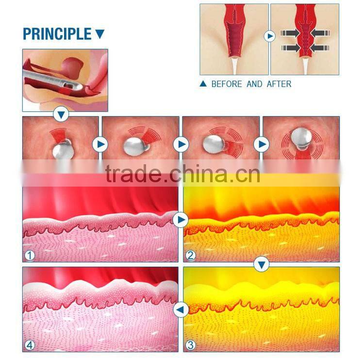 2016 Alibaba express scar repair beauty equipment Fractional CO2 Laser with usa imported laser tube