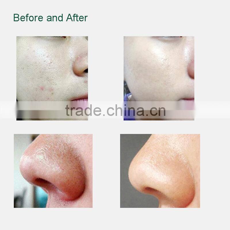 Hottest 6 Tip Facial Care Beauty Device scar removal machine black head remover machine with FDA