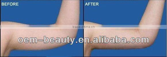 CE /OEM Super Body Sculptor RF body slimming machine FB F017