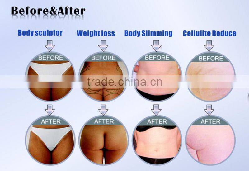 Body Contouring Cavitation RF Vacuum Lipo Laser Fast And Safe Delivery