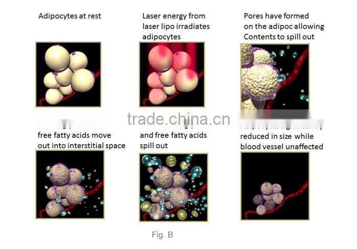 Best 12 Paddles Ilipo Laser 4 Wavelengthes Lipolaser Slimming Fat Removal lipo laser Equipment For Salon Use