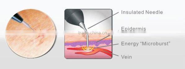 spider vein removal use 30MHz handled vascular doppler equipment for sale