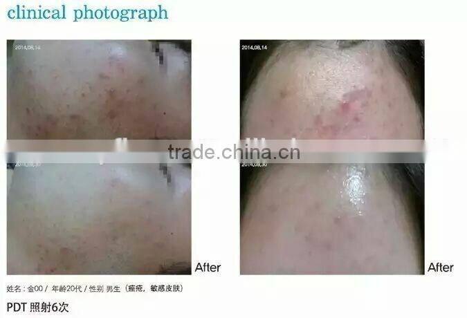 2016 Manufacture newest LED bio therapy equipment photon light therapy rejuvenation PDT equipment