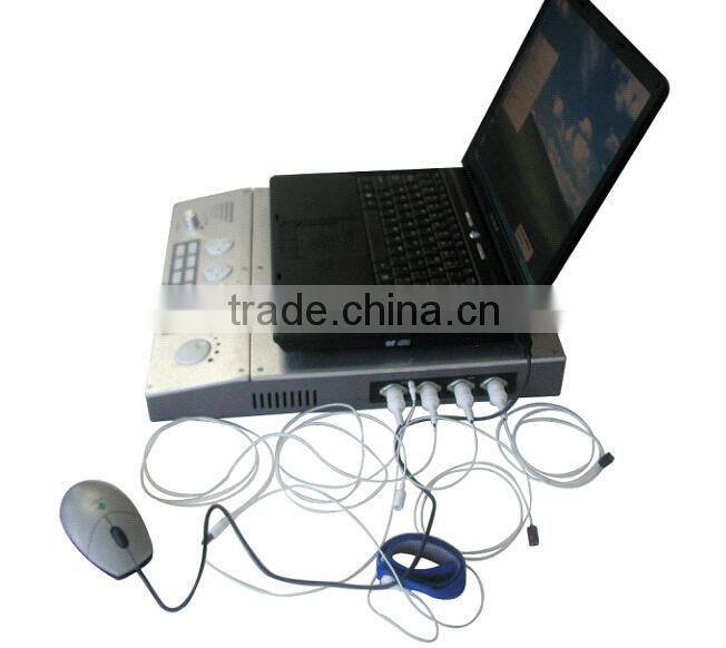 EMG EP Systems Electromyography