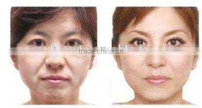 Table Facial Fractional rf skin tightening machine, radio frequency with cheaper price -F-TJ03