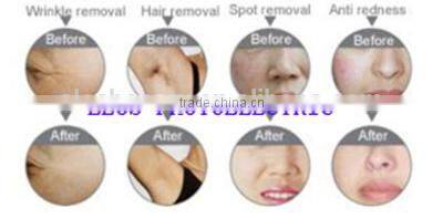 full power portable ipl hair removal machine really works