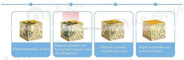 ND yag laser tattoo removal birth mark remover machine q switch nd yag laser machine