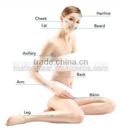 Painless and High Effect Permanent hair removal 810nm diode laser