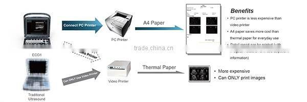 medical 2d Chison eco b w portable ultrasound machine