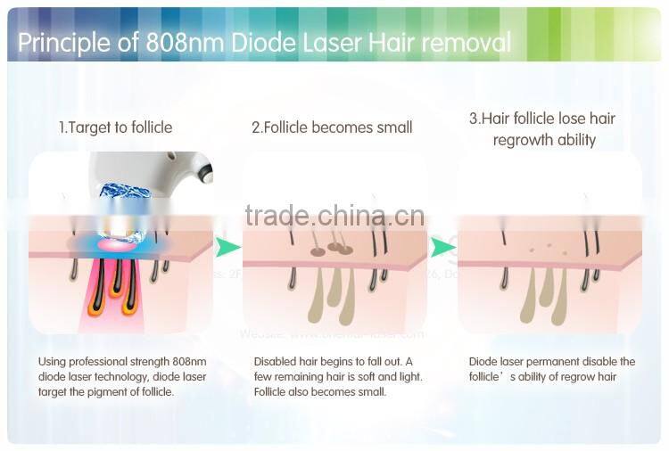 vertical and stationary laser hair removal machine 808 diode laser on sale