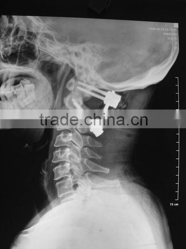 Agfa x-ray film, medical dry film sale from factory in China, we are producer