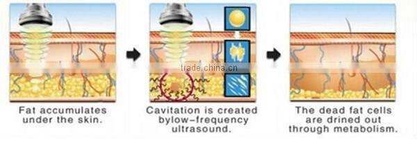 2014 best-selling multifunctional cavi/rf/vacuum beauty salon use ultra lipo cavitation+rf beauty slimming machine