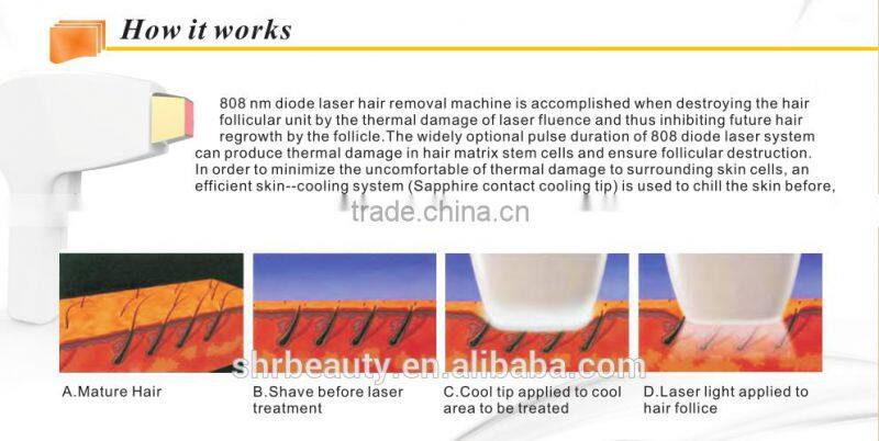 Hair Removal Laser Machines 808nm diode laser