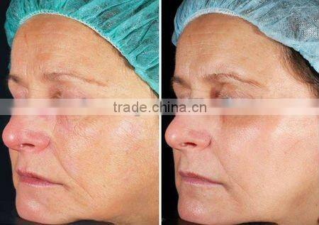 Cleaning skin tools Facial cleansing Brush