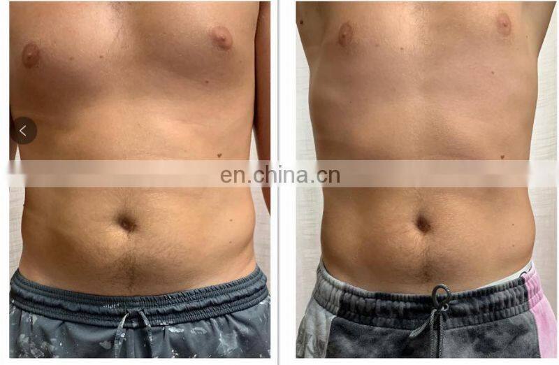 High quality electrical muscle stimulation device electromagnetic tesla hip trainer physiotherapy muscle stimulator