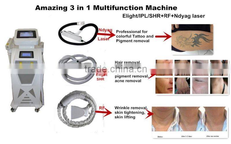 IPL+RF+ND YAG ipl/rf/tattoo beauty machine