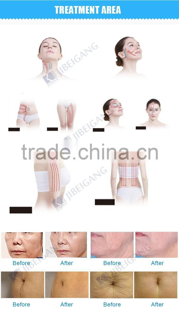 ce approval monopolar fractional rf wrinkle removal machine