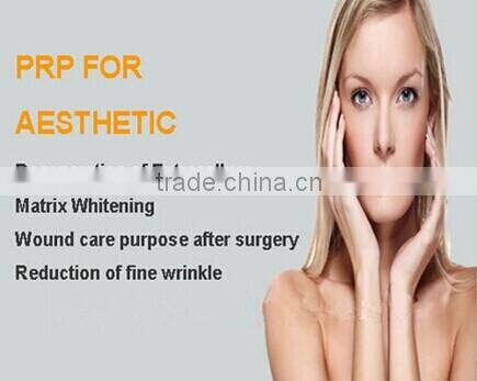 small TD4C hot sale PRP centrifuge separating 10ml PRP tube/kit