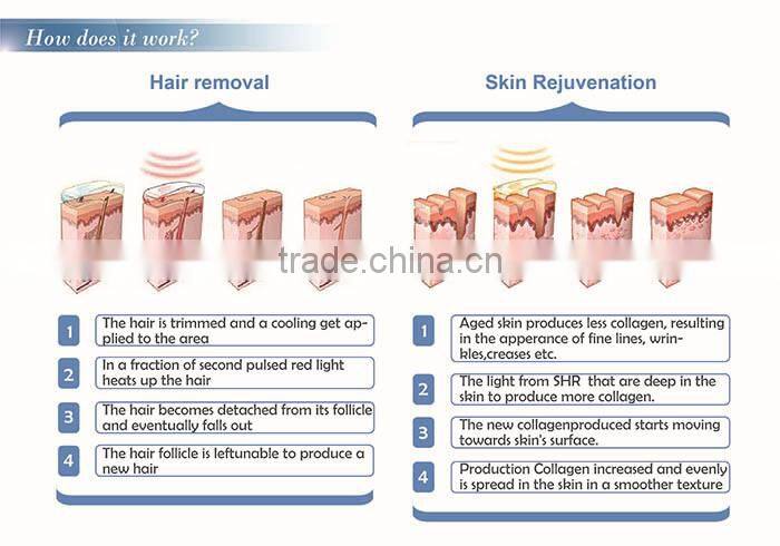 China OEM& ODM high profiency e-light ipl shr laser spa Hair removal machine for beauty spa/salon/ home